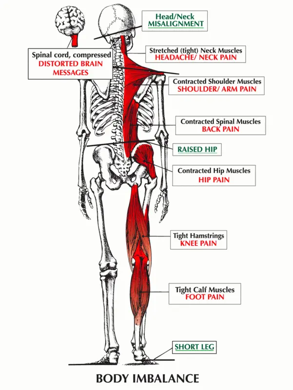 Concussion Treatment Chiropractor in Mount Dora, FL Near Me Concussion Body Diagram