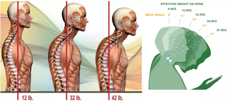 Neck Pain Conditions Treatment Forward Posture Chiropractor Mount Dora, FL