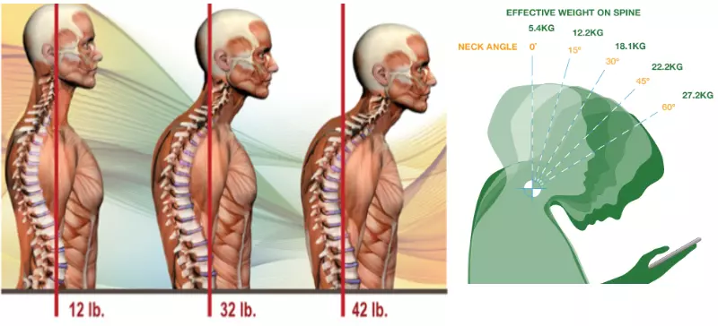 The Link Between Posture and Chronic Neck and Upper Back Pain — Back Pain  and Headache Specialist - Burke VA - NOVA Headache & Chiropractic Center