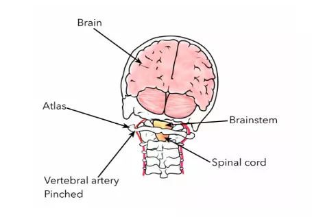 Vertigo Treatment Chiropractor in Mount Dora, FL Chiropractor Near Me